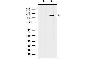 anti-Integrin, alpha E (Antigen CD103, Human Mucosal Lymphocyte Antigen 1, alpha Polypeptide) (ITGAE) (N-Term) antibody