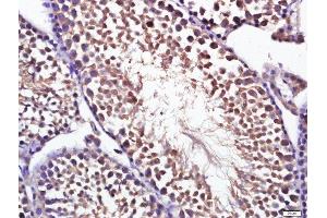 Paraformaldehyde-fixed, paraffin embedded mouse testis, Antigen retrieval by boiling in sodium citrate buffer (pH6. (OPTN antibody  (AA 341-440))