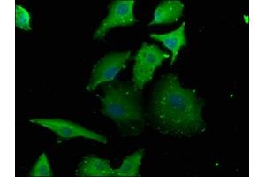 Immunofluorescence staining of U251 cells with ABIN7153827 at 1:133, counter-stained with DAPI. (RABGGTB antibody  (AA 2-331))