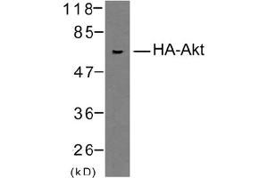 Image no. 1 for anti-HA-Tag antibody (ABIN319423) (HA-Tag antibody)