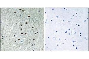 Immunohistochemistry analysis of paraffin-embedded human brain, using REXO1 Antibody. (REXO1 antibody  (AA 185-234))