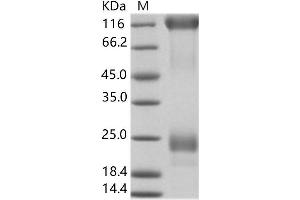 Western Blotting (WB) image for Zaire Ebola Virus Envelope Glycoprotein (ZEBOV GP) protein (His tag) (ABIN7198908) (ZEBOV GP Protein (His tag))
