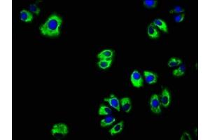 Immunofluorescence staining of HepG2 cells with ABIN7151894 at 1:166, counter-stained with DAPI. (EGFR antibody  (AA 1067-1210))