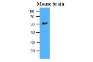 Western Blotting (WB) image for anti-Tubulin, beta 2B (TUBB2B) antibody (ABIN567630) (TUBB2B antibody)