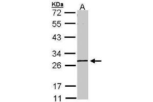 WB Image Sample (30 ug of whole cell lysate) A: A431 , 10% SDS PAGE antibody diluted at 1:1000 (GK5 antibody  (Center))