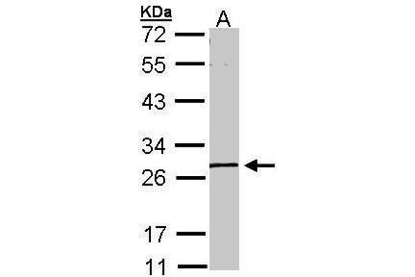 GK5 antibody  (Center)