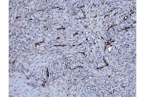 IHC analysis of EHD3 using anti-EHD3 antibody (ABIN7602777). (EHD3 antibody  (C-Term))