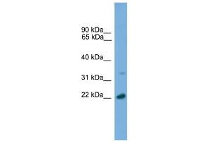 WB Suggested Anti-AP3S1 Antibody Titration: 0. (AP3S1 antibody  (C-Term))