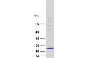 Validation with Western Blot