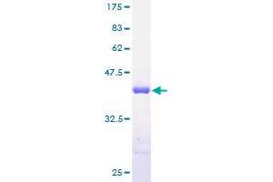 SH3BGRL Protein (AA 1-114) (GST tag)