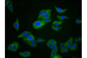 Immunofluorescence staining of HepG2 cells with ABIN7167470 at 1:266, counter-stained with DAPI. (RIPK1 antibody  (AA 328-458))
