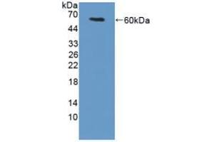 Western blot analysis of recombinant Mouse TGM1.
