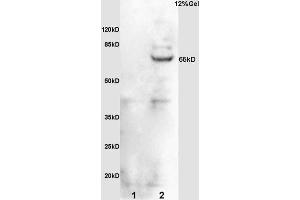 L1 rat brain lysates L2 mouse embryo lysates probed with Anti phospho-Cdc25B (Ser323) Polyclonal Antibody, Unconjugated (ABIN756952) at 1:200 overnight at 4 °C. (CDC25B antibody  (pSer323))