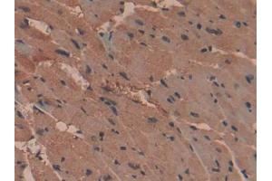 DAB staining on IHC-P; Samples: Mouse Heart Tissue (RNPEP antibody  (AA 112-358))