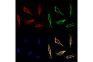 ABIN7094220 and ABIN7098266 staining Hela cells by IF/ICC.