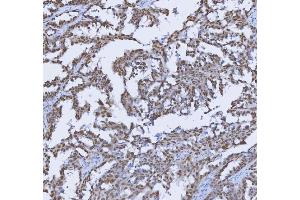 IHC analysis of TRMT6 using anti-TRMT6 antibody (ABIN7602138).