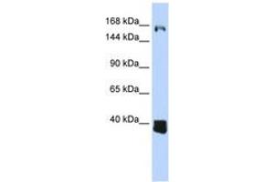 Image no. 1 for anti-Ligand Dependent Nuclear Receptor Corepressor (Lcor) (AA 1080-1129) antibody (ABIN6743824)