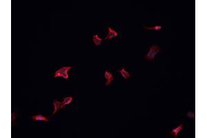 ABIN6266832 staining HeLa  cells by IF/ICC. (MAP4K4 antibody  (Internal Region))