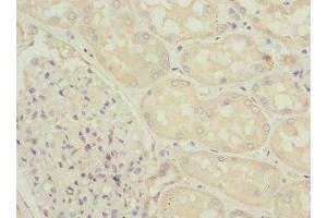 Immunohistochemistry of paraffin-embedded human kidney tissue using ABIN7176063 at dilution of 1:100
