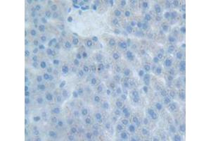 Figure. (EPOR antibody  (AA 314-467))