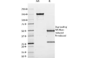 SDS-PAGE Analysis Purified CD10 Mouse Monoclonal Antibody (MME/1620).