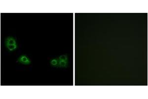 Immunofluorescence analysis of MCF7 cells, using TMEM185A Antibody. (TMEM185A antibody  (AA 290-339))