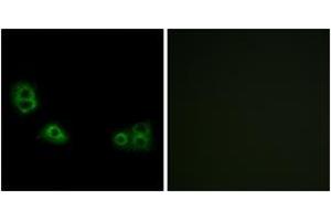 Immunofluorescence analysis of MCF7 cells, using TMEM185A Antibody.