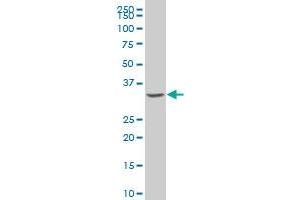 NRBP2 polyclonal antibody (A01), Lot # 060619JCS1 Western Blot analysis of NRBP2 expression in Y-79 . (NRBP2 antibody  (AA 151-258))