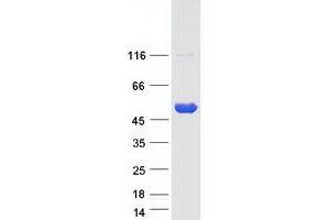 Western Blotting (WB) image for Phosphatidylinositol-5-Phosphate 4-Kinase, Type II, beta (PIP4K2B) protein (Myc-DYKDDDDK Tag) (ABIN2729006)