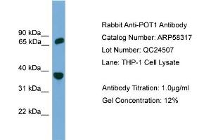 WB Suggested Anti-POT1  Antibody Titration: 0. (POT1 antibody  (Middle Region))