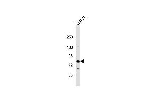Anti-LCP2 Antibody (N-Term) at 1:2000 dilution + Jurkat whole cell lysate Lysates/proteins at 20 μg per lane. (LCP2 antibody  (AA 46-80))