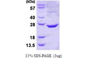 CTD Small Phosphatase-Like Protein (CTDSPL) (AA 82-265) protein (His tag)