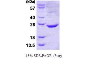 SDS-PAGE (SDS) image for CTD Small Phosphatase-Like Protein (CTDSPL) (AA 82-265) protein (His tag) (ABIN667673)