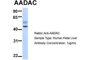 Host:  Rabbit  Target Name:  AADAC  Sample Type:  Human Fetal Liver  Antibody Dilution:  1. (AADAC antibody  (N-Term))