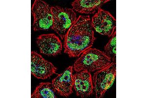 Fluorescent confocal image of  cell stained with KLF5 Antibody (C-term) (ABIN391515 and ABIN2841476). (KLF5 antibody  (C-Term))