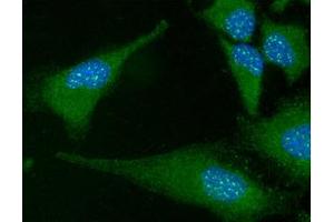 ICC/IF analysis of FADD in HeLa cells line, stained with DAPI (Blue) for nucleus staining and monoclonal anti-human FADD antibody (1:100) with goat anti-mouse IgG-Alexa fluor 488 conjugate (Green). (FADD antibody  (AA 1-208))