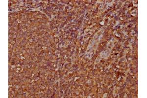 IHC image of ABIN7156081 diluted at 1:300 and staining in paraffin-embedded human tonsil tissue performed on a Leica BondTM system. (IGHA2 antibody  (AA 36-111))