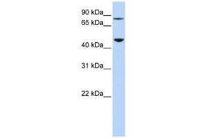 DPH2 antibody used at 1 ug/ml to detect target protein. (DPH2 antibody)