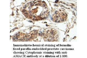 Image no. 1 for anti-alpha-Methylacyl-CoA Racemase (AMACR) antibody (ABIN791220) (AMACR antibody)