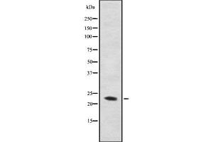 Western blot analysis of C56D2 using COS7 whole cell lysates (CYB561D2 antibody)