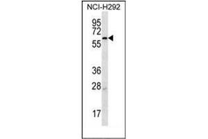Western blot analysis of MBTPS2 Antibody (N-term) in NCI-H292 cell line lysates (35ug/lane). (MBTPS2 antibody  (N-Term))