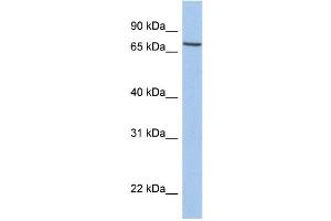 Western Blotting (WB) image for anti-Solute Carrier Family 20 (Phosphate Transporter), Member 1 (SLC20A1) (C-Term) antibody (ABIN2773834)
