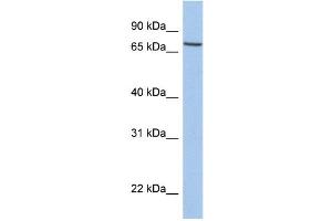 WB Suggested Anti-SLC20A1 Antibody Titration:  0. (SLC20A1 antibody  (C-Term))