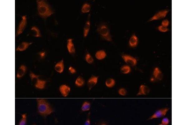 TMEM25 antibody