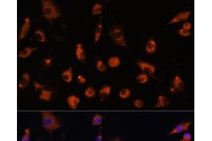 Immunofluorescence analysis of L929 cells using TMEM25 Polyclonal Antibody at dilution of 1:100. (TMEM25 antibody)