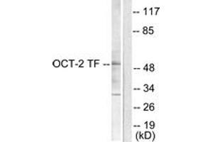 Western blot analysis of extracts from COS7 cells, using OCT2 Antibody. (Oct-2 antibody  (AA 1-50))