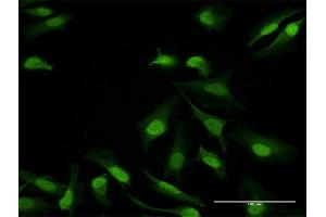 Immunofluorescence of purified MaxPab antibody to DDB1 on HeLa cell. (DDB1 antibody  (AA 1-1140))