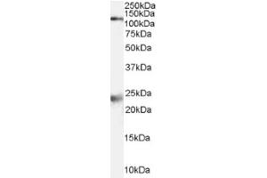 Image no. 1 for anti-NMDA Receptor 1 (NMDA R1) (Internal Region) antibody (ABIN374717) (NMDA 1 Receptor antibody  (Internal Region))
