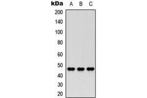 Western blot analysis of Nocturnin expression in HEK293T (A), PC12 (B), HeLa (C) whole cell lysates. (CCRN4L antibody  (Center))