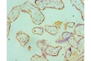 Immunohistochemistry of paraffin-embedded human placenta tissue using ABIN7171193 at dilution of 1:100 (Syndecan 1 antibody  (AA 25-240))